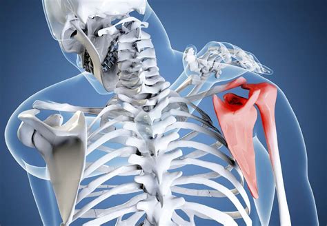 Как снять боль при остеохондрозе плечевого сустава?